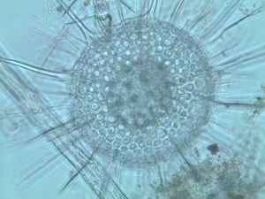 Alt du ikke visste om radiolarer