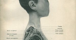 Kroppen i økologisk krise